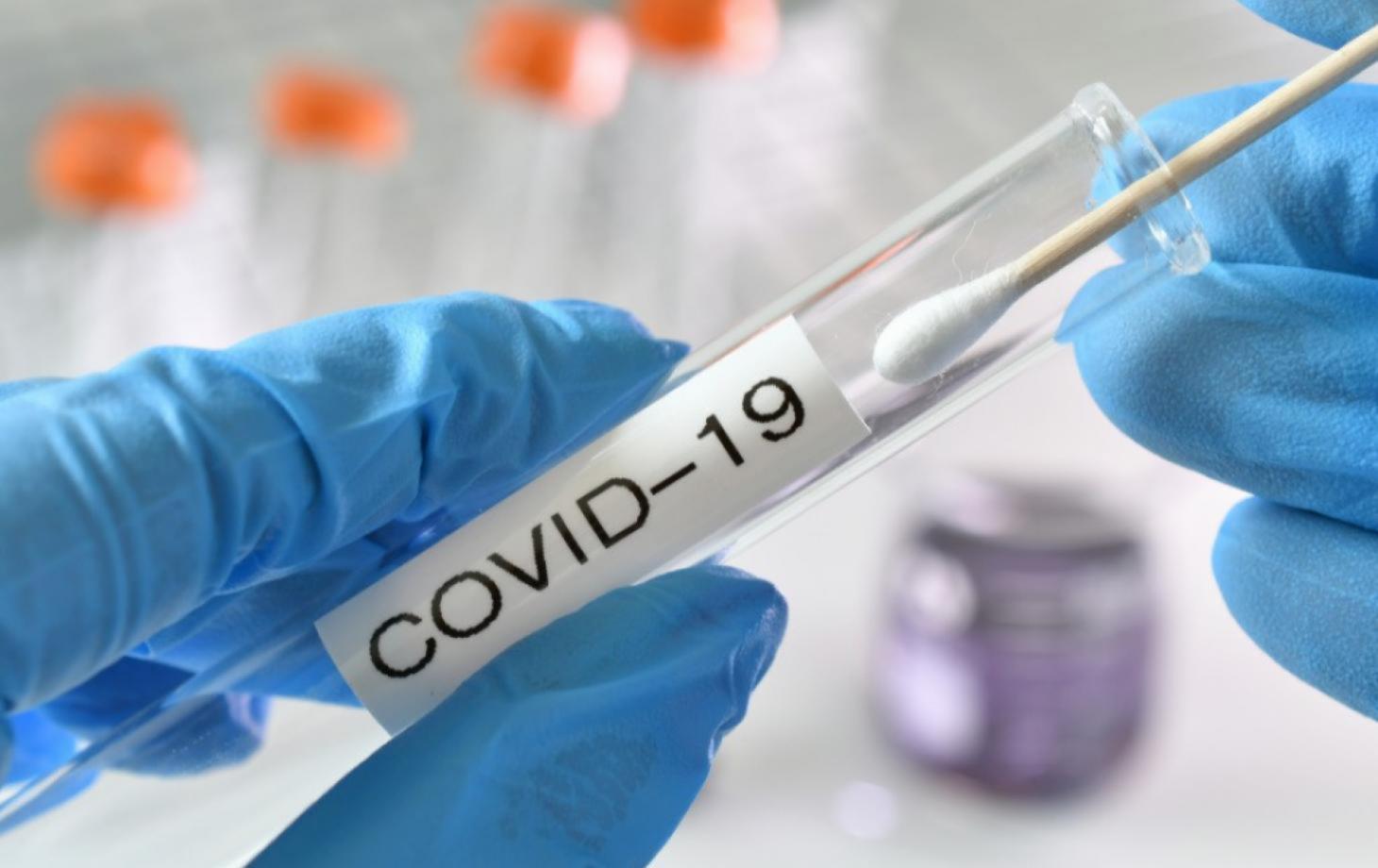 testing swab being inserted test tube labeled covid 19 positive negative results lab laboratory t20 n0vgob 2 0